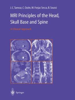 Paperback MRI Principles of the Head, Skull Base and Spine: A Clinical Approach Book