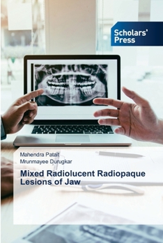 Paperback Mixed Radiolucent Radiopaque Lesions of Jaw Book