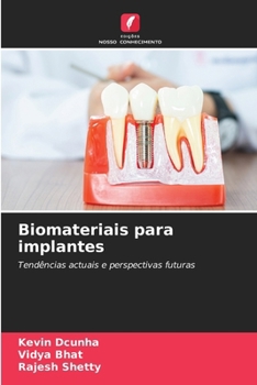 Paperback Biomateriais para implantes [Portuguese] Book