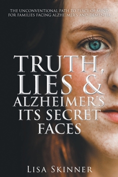 Paperback Truth, Lies & Alzheimer's Its Secret Faces Book