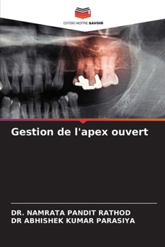 Paperback Gestion de l'apex ouvert [French] Book