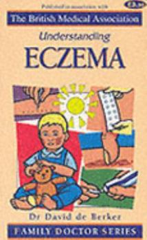 Paperback Eczema (Understanding) Book