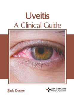 Hardcover Uveitis: A Clinical Guide Book