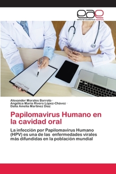 Paperback Papilomavirus Humano en la cavidad oral [Spanish] Book