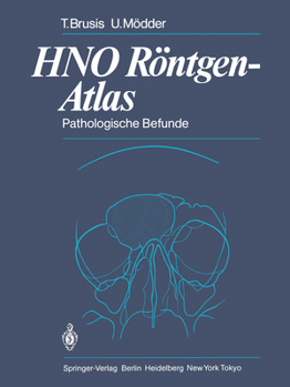 Paperback Hno Röntgen-Atlas: Pathologische Befunde [German] Book