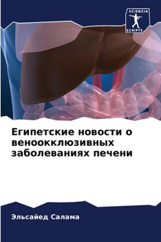 Paperback Египетские новости о вен [Russian] Book