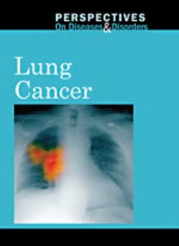 Library Binding Lung Cancer Book