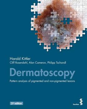 Paperback Dermatoscopy: Pattern analysis of pigmented and non-pigmented lesions Book