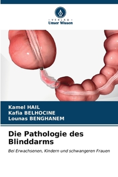 Paperback Die Pathologie des Blinddarms [German] Book