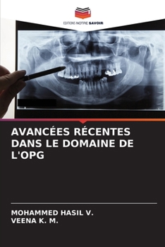 Paperback Avancées Récentes Dans Le Domaine de l'Opg [French] Book