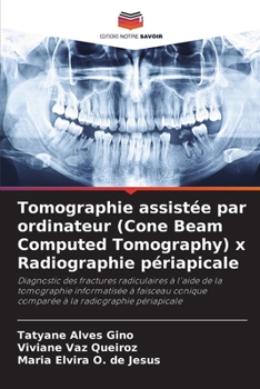 Paperback Tomographie assistée par ordinateur (Cone Beam Computed Tomography) x Radiographie périapicale [French] Book