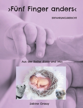 F?nf Finger anders: Erfahrungsbericht