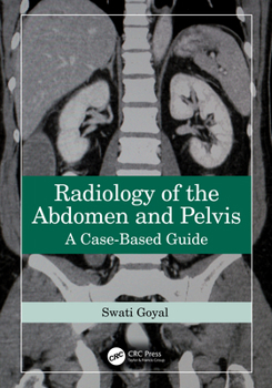 Paperback Radiology of the Abdomen and Pelvis: A Case-Based Guide Book