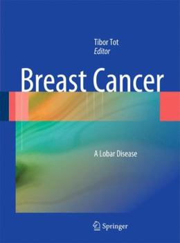 Hardcover Breast Cancer: A Lobar Disease Book