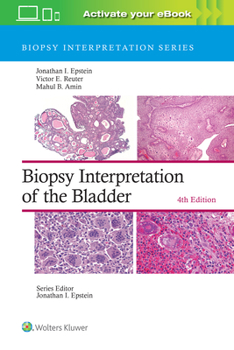 Hardcover Biopsy Interpretation of the Bladder: Print + eBook with Multimedia Book
