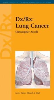 Paperback DX/RX: Lung Cancer Book