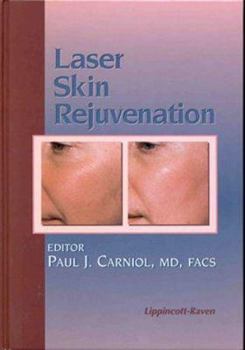 Hardcover Laser Skin Rejuvenation Book