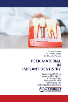Paperback Peek Material in Implant Dentistry Book