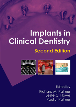 Hardcover Implants in Clinical Dentistry Book
