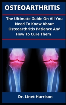 Paperback Osteoarthritis: The Ultimate Guide On All You Need To Know About Osteoarthritis Patience And How To Cure Them Book