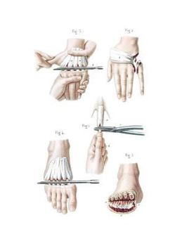 Paperback Amputations in the Continuity of the Bones Composition Notebook: Wide Ruled Note-Taking Book