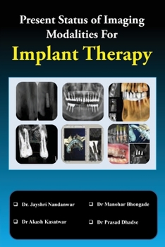 Paperback Present Status of Imaging Modalities For Implant Therapy Book