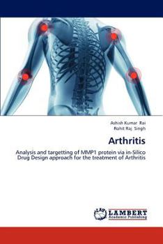Arthritis: Analysis and targetting of MMP1 protein via in-Silico Drug Design approach for the treatment of Arthritis