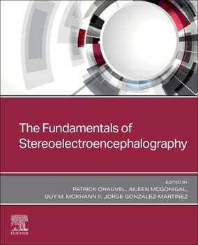 Paperback The Fundamentals of Stereoelectroencephalography Book