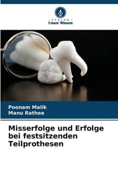 Misserfolge und Erfolge bei festsitzenden Teilprothesen (German Edition)