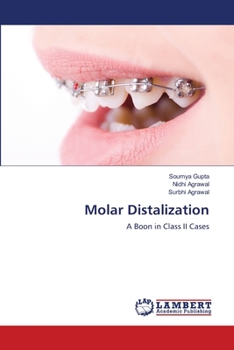 Paperback Molar Distalization Book