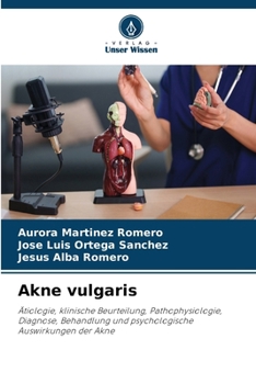 Akne vulgaris (German Edition)