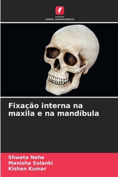 Fixação interna na maxila e na mandíbula (Portuguese Edition)