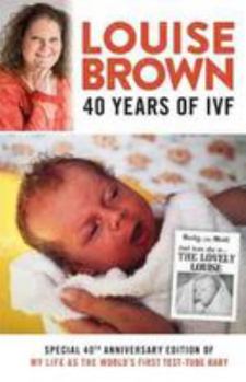 Paperback Louise Brown: 40 Years of IVF Book