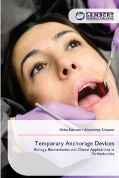 Paperback Temporary Anchorage Devices Book