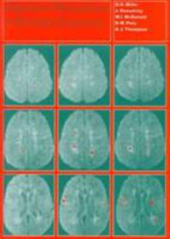 Hardcover Magnetic Resonance in Multiple Sclerosis Book