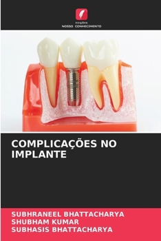 Paperback Complicações No Implante [Portuguese] Book