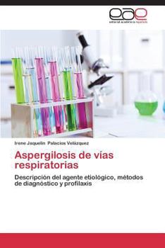 Paperback Aspergilosis de vías respiratorias [Spanish] Book