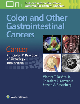 Paperback Colon and Other Gastrointestinal Cancers: Cancer: Principles & Practice of Oncology, 10th Edition Book