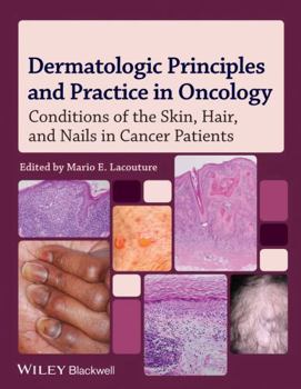 Dermatology and the Cancer Patient: Conditions of the Skin, Hair, and Nails During Cancer Treatment