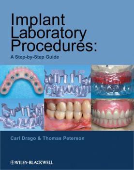 Spiral-bound Implant Laboratory Procedures: A Step-By-Step Guide Book
