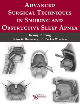 Paperback Advanced Surgical Techniques in Snoring and Obstructive Sleep Apnea Book