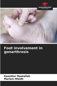 Paperback Foot involvement in gonarthrosis Book