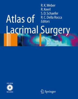 Hardcover Atlas of Lacrimal Surgery [With DVD-ROM] Book