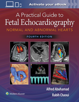 Hardcover A Practical Guide to Fetal Echocardiography: Normal and Abnormal Hearts Book