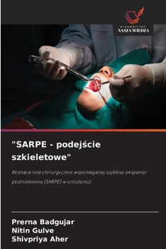 "SARPE - podejscie szkieletowe" (Polish Edition)