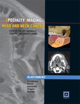 Hardcover Head and Neck Cancer: State of the Art Diagnosis, Staging, and Surveillance Book