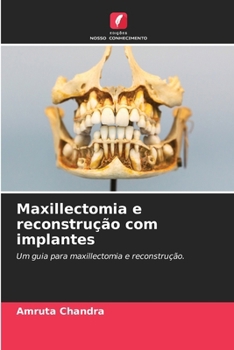 Paperback Maxillectomia e reconstrução com implantes [Portuguese] Book