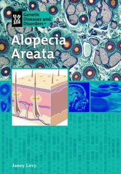 Library Binding Alopecia Areata Book