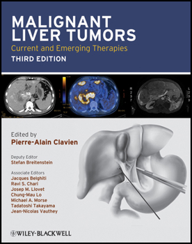 Hardcover Malignant Liver Tumors: Current and Emerging Therapies Book