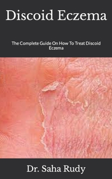 Paperback Discoid Eczema: The Complete Guide On How To Treat Discoid Eczema Book